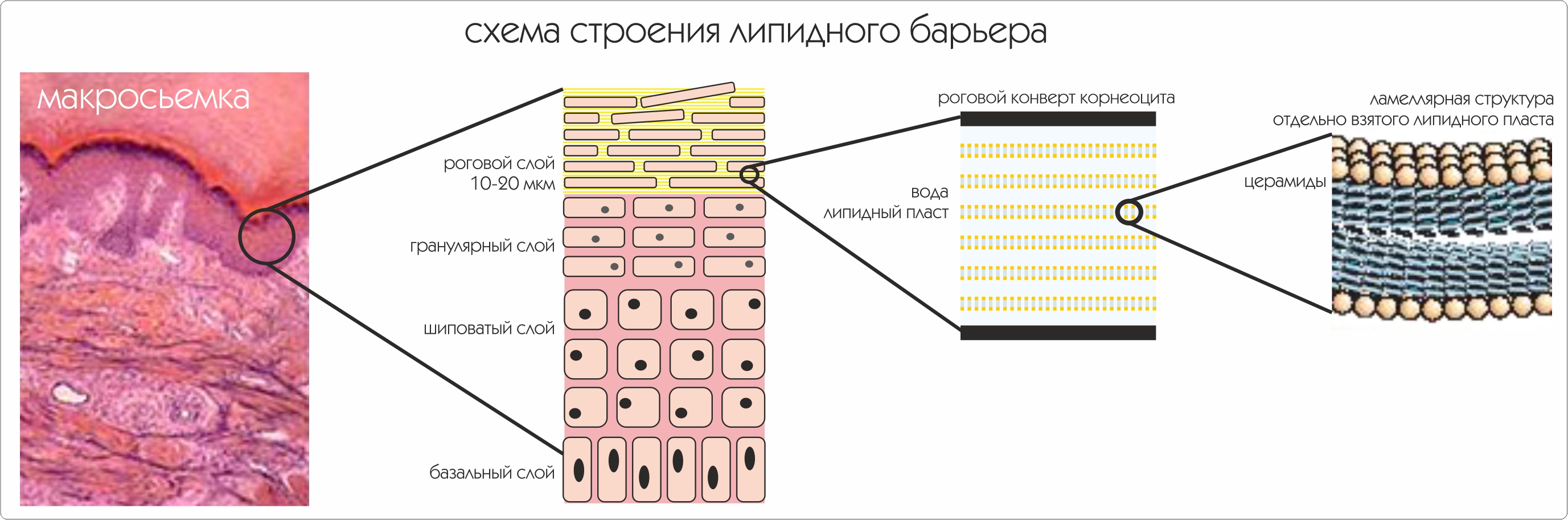 lipidny